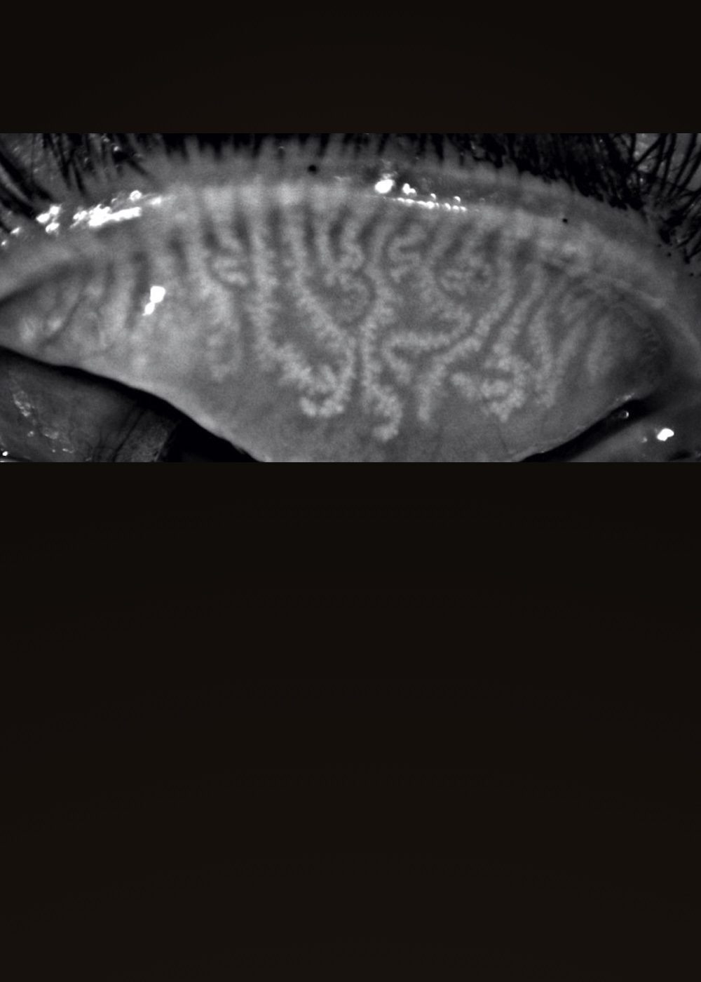 Meibografia-servicios