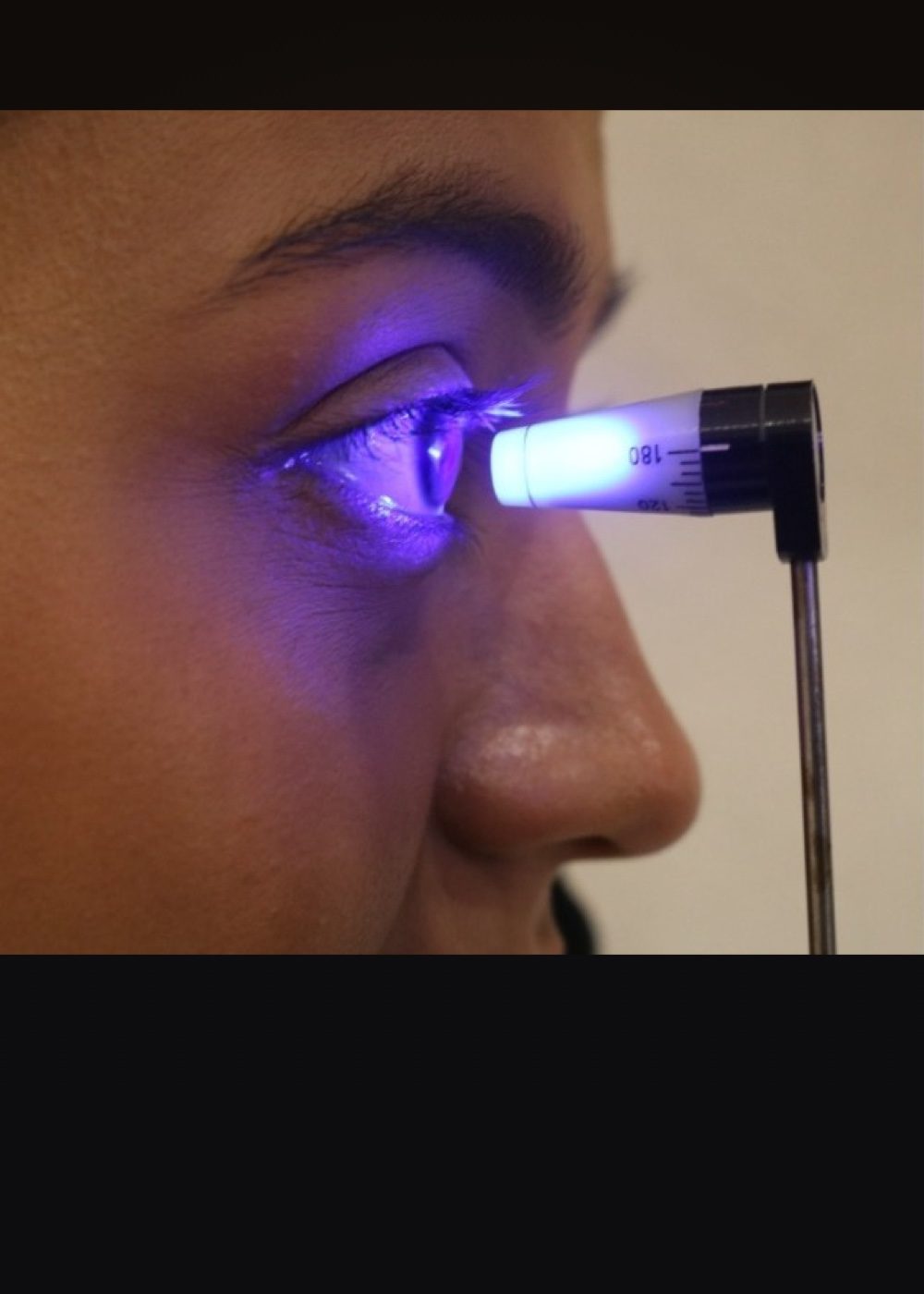 estudio presion ocular dralex