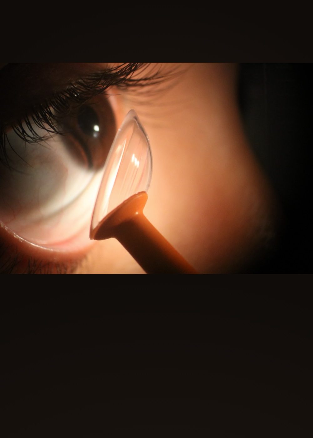 lentes esclerales dralex